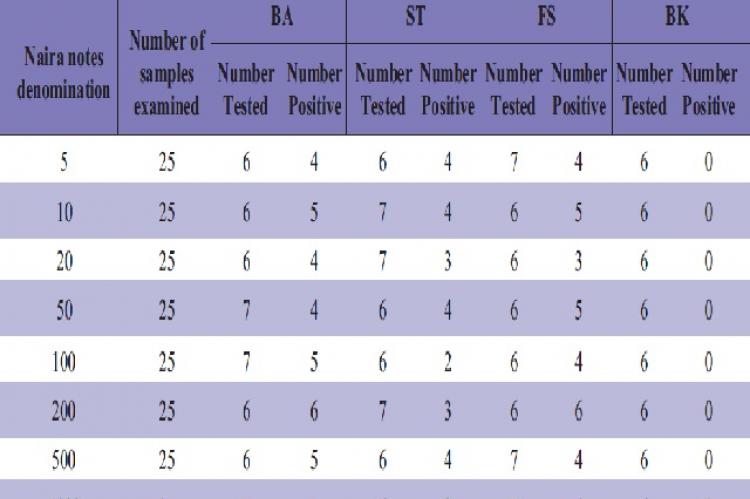 Distribution Escherichia coli isolated from Naria notes in relation to source 