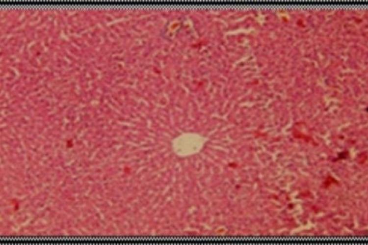 Section of liver showing normal hepatic cells 