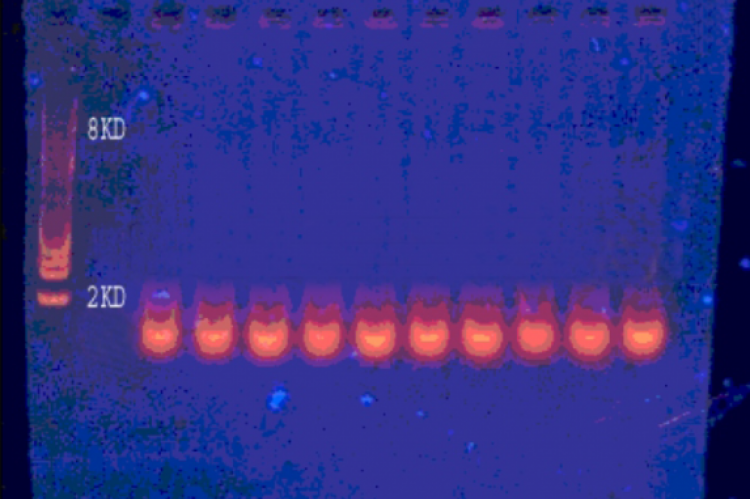 Gel electrophoresis of plasmid DNA isolated from methicillin resistant Staphylococcus aureus isolates.