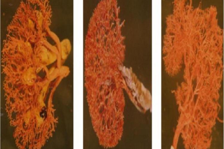 Renal segmenatation of Human, Goat and Buffalo kidney