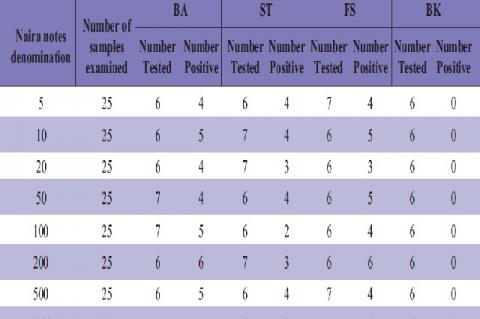 Distribution Escherichia coli isolated from Naria notes in relation to source 