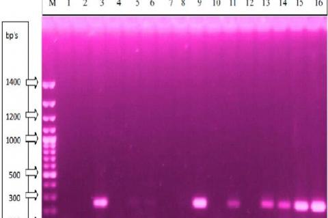 Agarose gel electrophoresis 