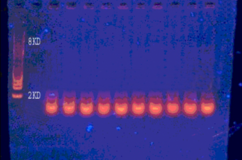 Gel electrophoresis of plasmid DNA isolated from methicillin resistant Staphylococcus aureus isolates.