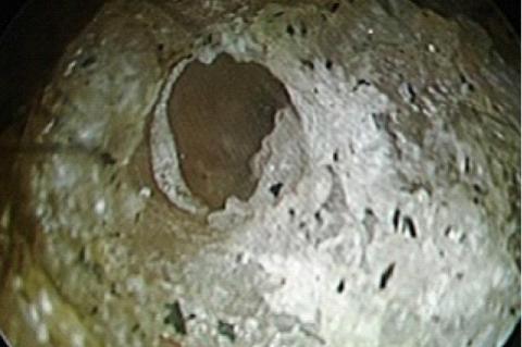 Dried adhesive glue removed in piecemeal.
