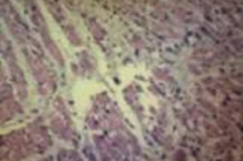 Photomicrographs of Heart Section
