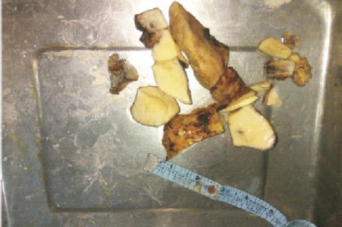 The operated specimen